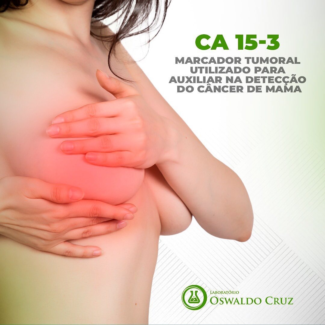 MARCADOR TUMORAL CA-15-3