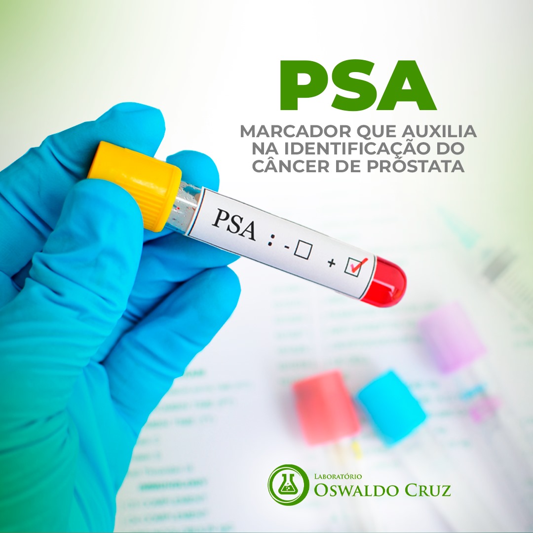 PSA - Marcador que auxilia na identificação do câncer de próstata
