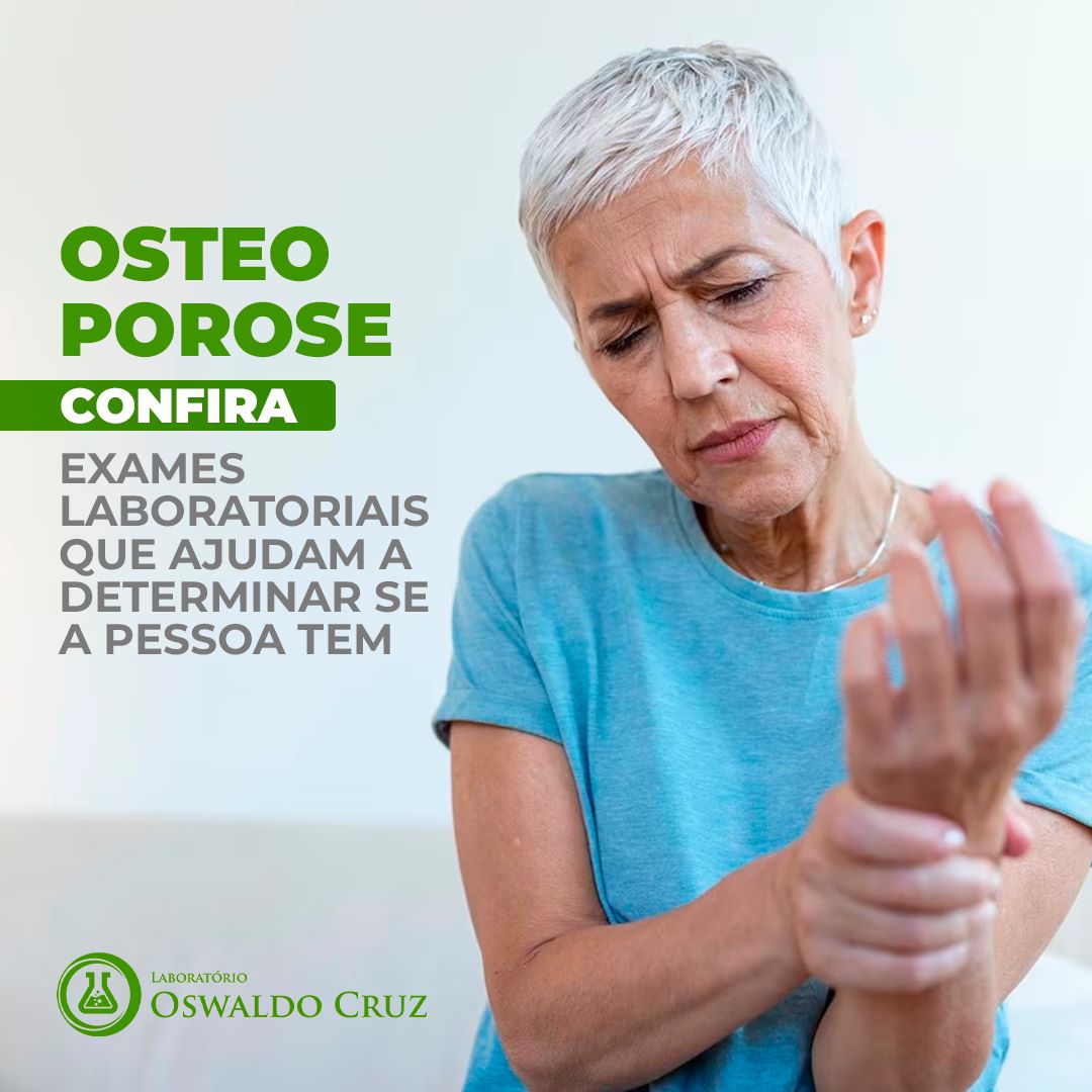 OSTEOPOROSE: NÃO TEM CURA, PREVINA