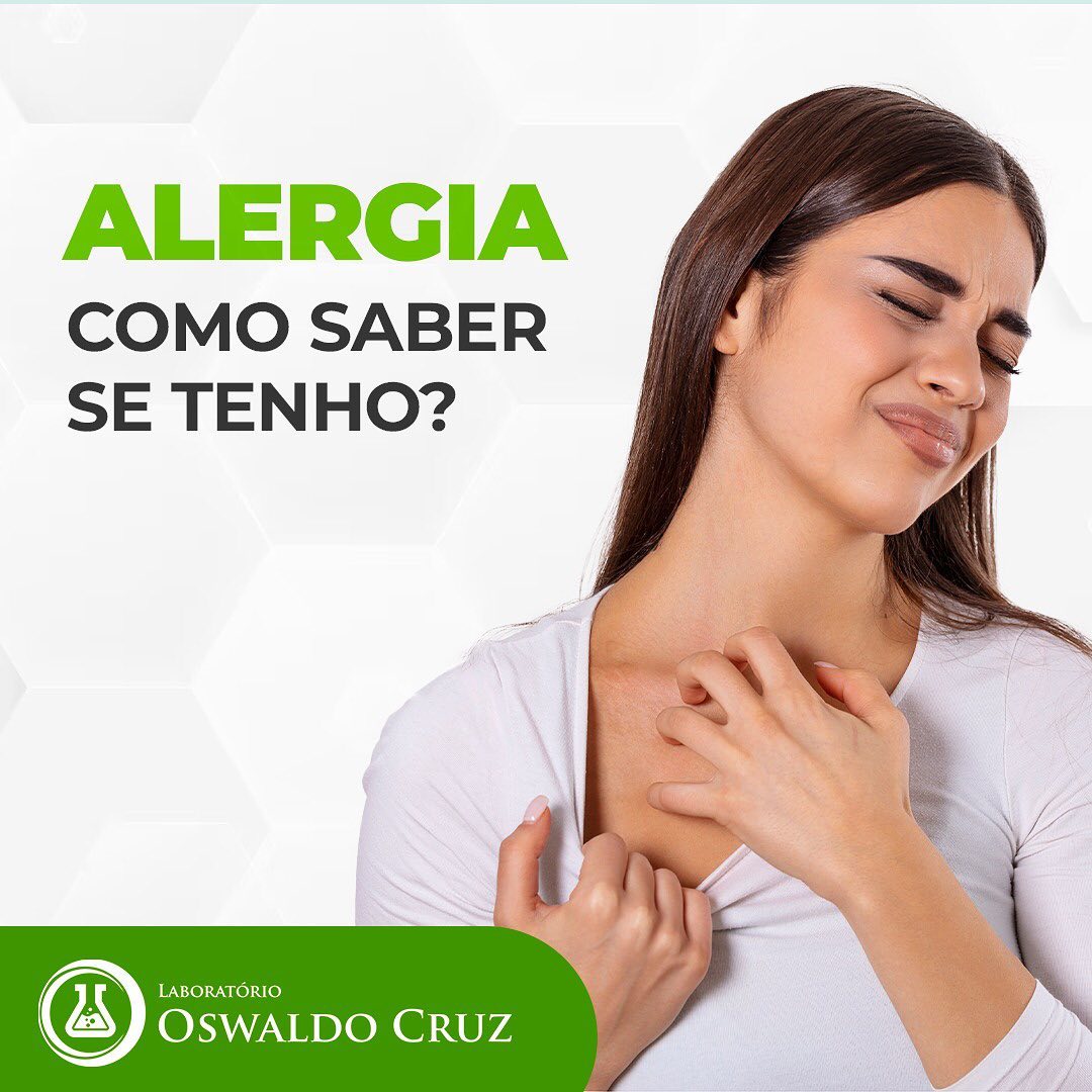 ALERGIA