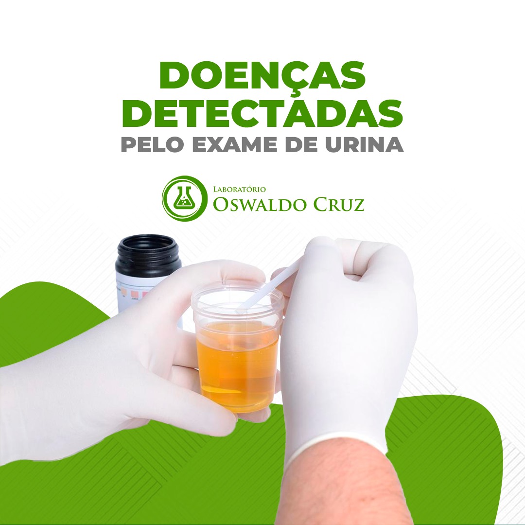 EXAME DE URINA - Doenças detectáveis