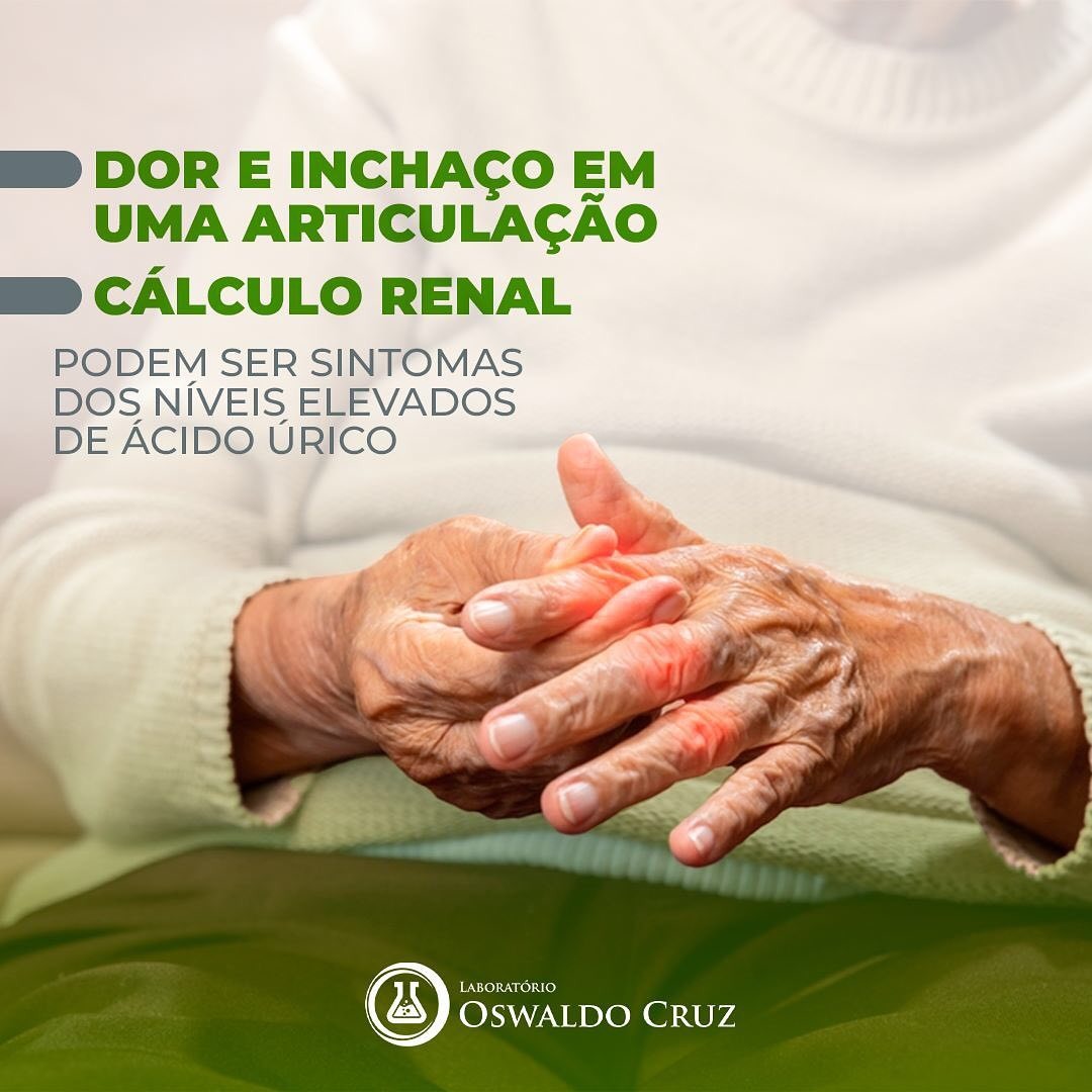 Ácido Úrico