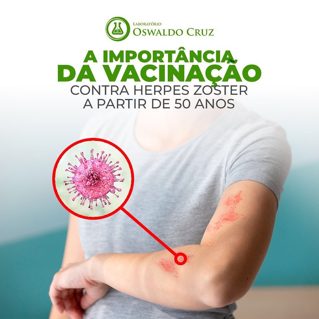 Herpes Zoster - Tem vacina! 